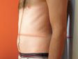 Abdomen sans préparation — Incidence de face