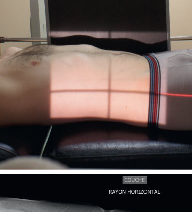 Abdomen sans préparation — Incidence de profil latéral