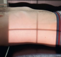 Abdomen sans préparation — Incidence de profil latéral