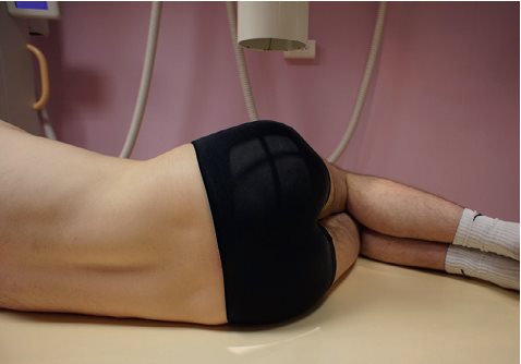 Coccyx — Incidence de profil