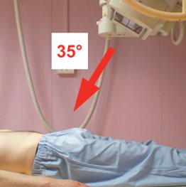 Incidence traumatologique de face — Outlet