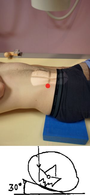 Articulation sacro-iliaque — Oblique postérieure