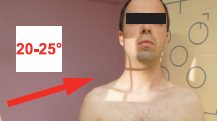 Rachis cervical – Incidence oblique