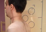 Rachis cervical – Incidence de profil