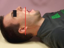 Charnière cervico-occipitale – Incidence de face, bouche ouverte