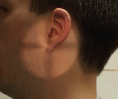 Charnière cervico-occipitale – Incidence de profil – Position neutre