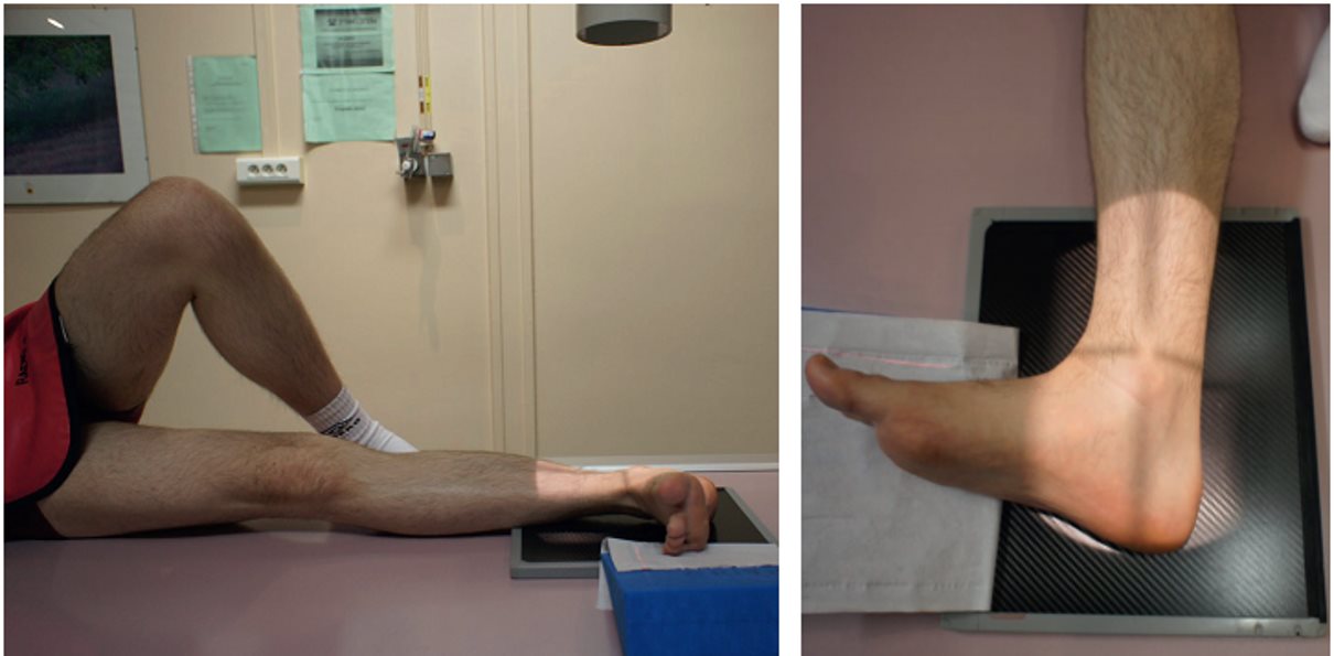 Incidence dynamique — Flexion dorsale maximale
