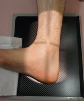Incidence dynamique — Flexion dorsale maximale