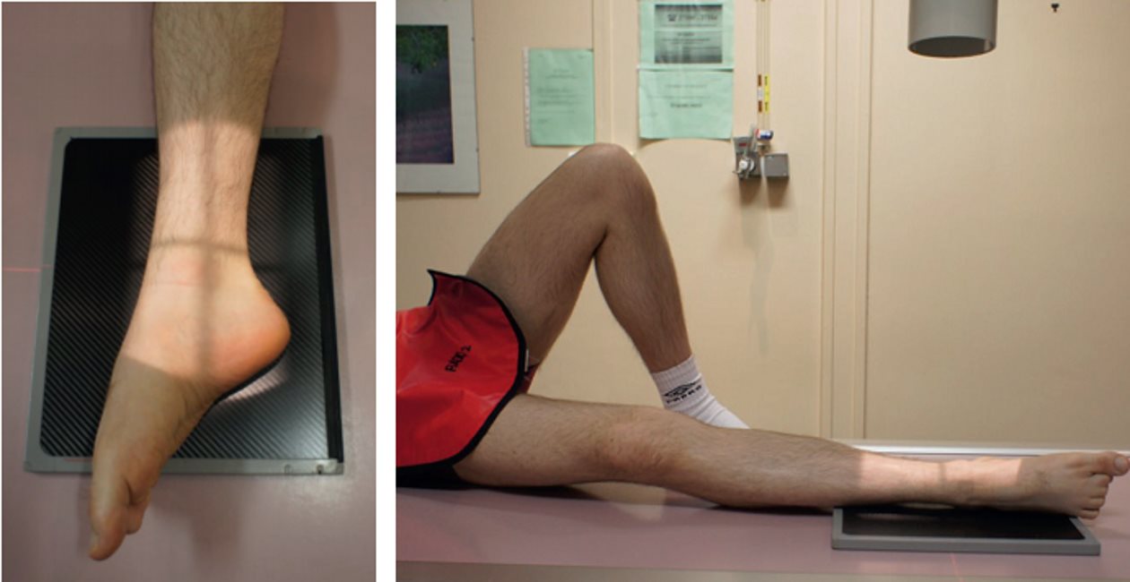 Incidence dynamique — Flexion plantaire maximale
