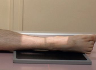 Incidence dynamique — Flexion plantaire maximale