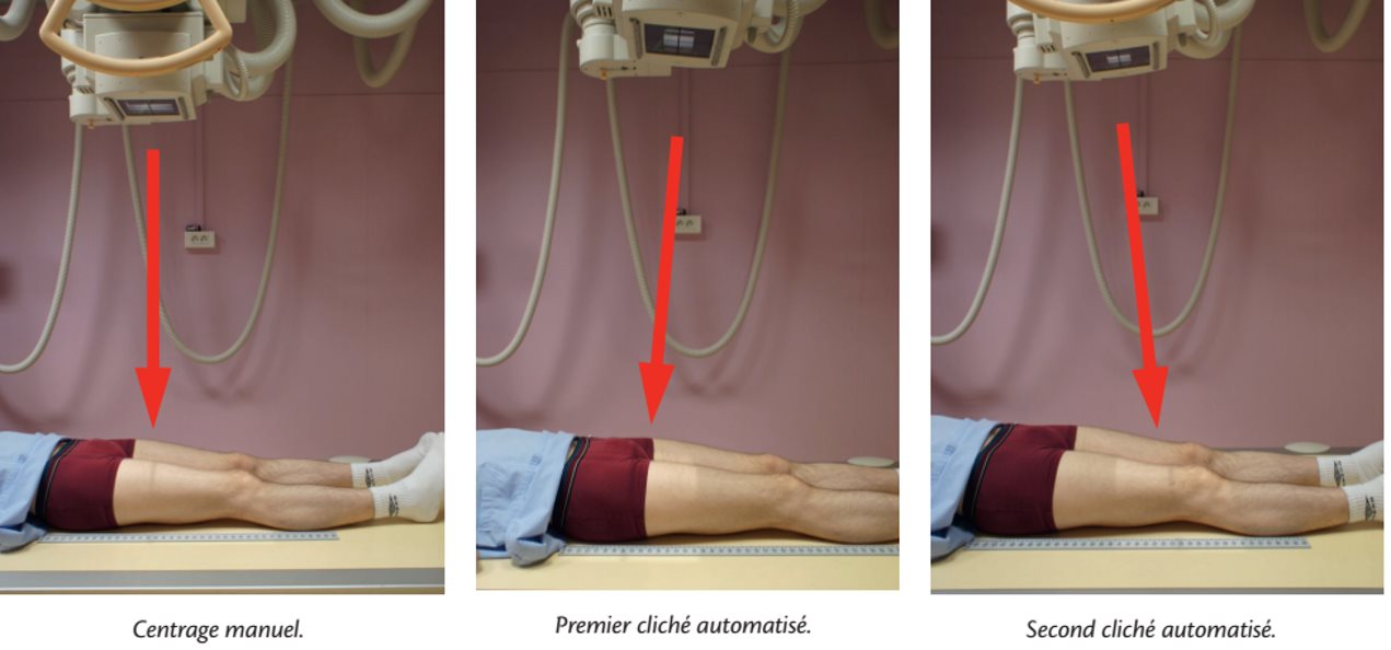 Incidence de face — Modestitching