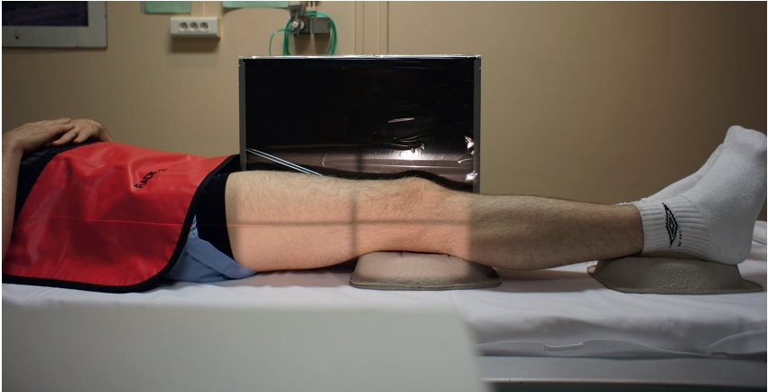 Incidence de profil médial en décubitus dorsal (traumatisme)