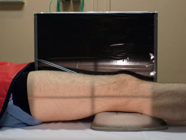 Incidence de profil médial en décubitus dorsal (traumatisme)