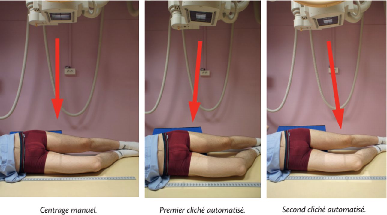 Incidence de profil — Modestitching
