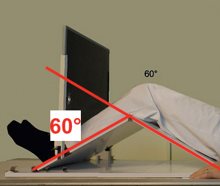 Défilé fémoropatellaire à 60°
