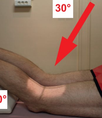Incidence de l'échancrure intercondylienne