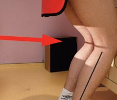 Incidence de face en charge à 30° de flexion (schuss)