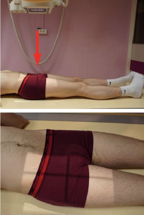 Incidence traumatologique de face décentrée