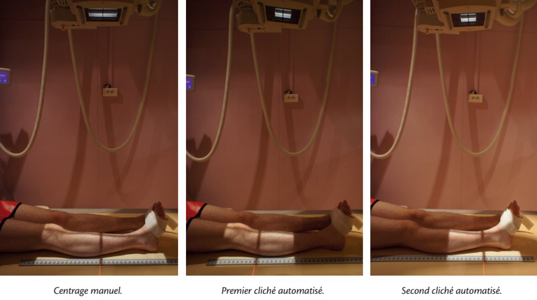 Incidence de face — Modestitching