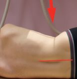Incidence de profil en décubitus latéral