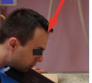 Os nasaux – Incidence de Gosserez et Treheux