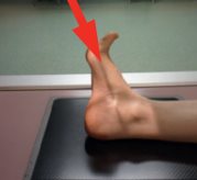 Articulation sous-talienne — Incidence en rotation latérale