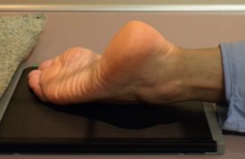 Incidence de l'articulation tarsométatarsienne (Lisfranc)