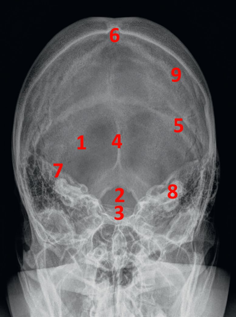 RX