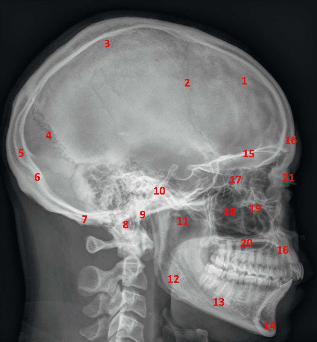 RX