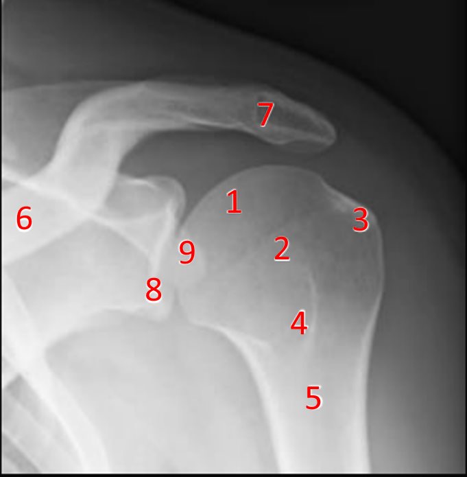 RX
