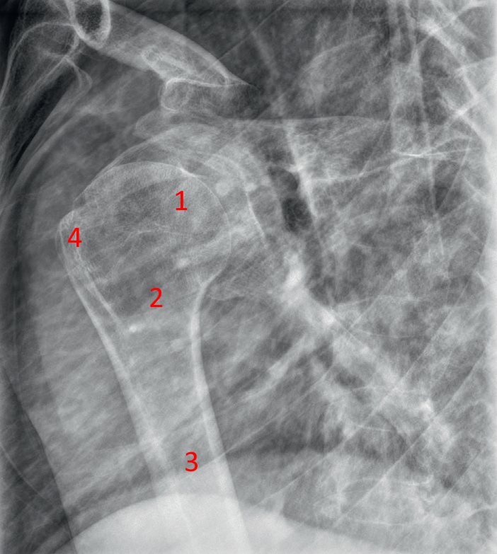 RX