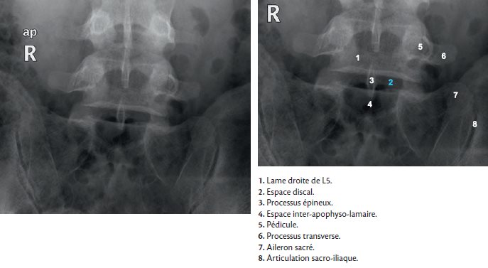 RX