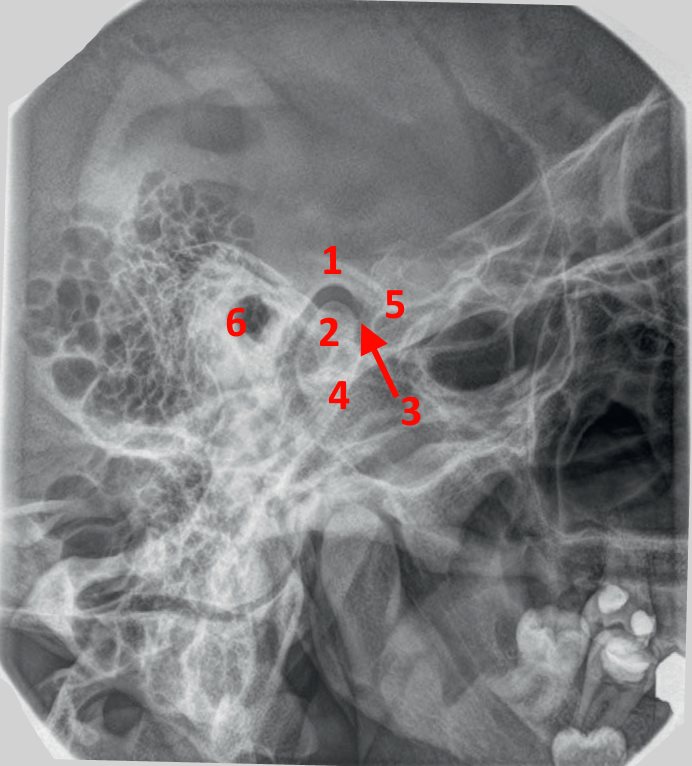 RX