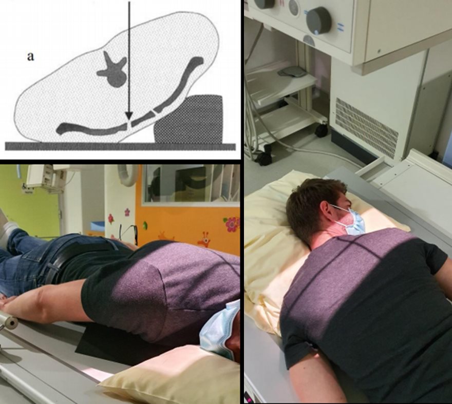 Art. sterno-claviculaire – Oblique antérieure